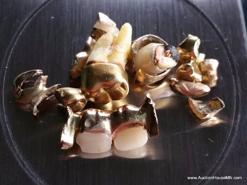 Gold Fillings - 24.6 Grams